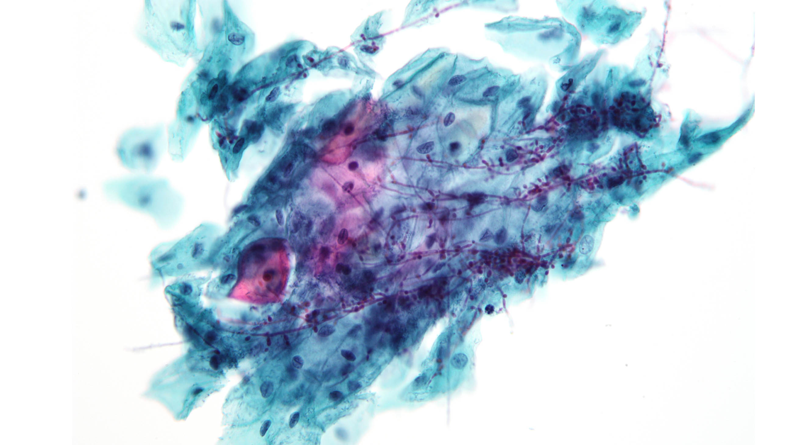 Discounting a superficial infection could prove deadly if it were to enter the bloodstream.