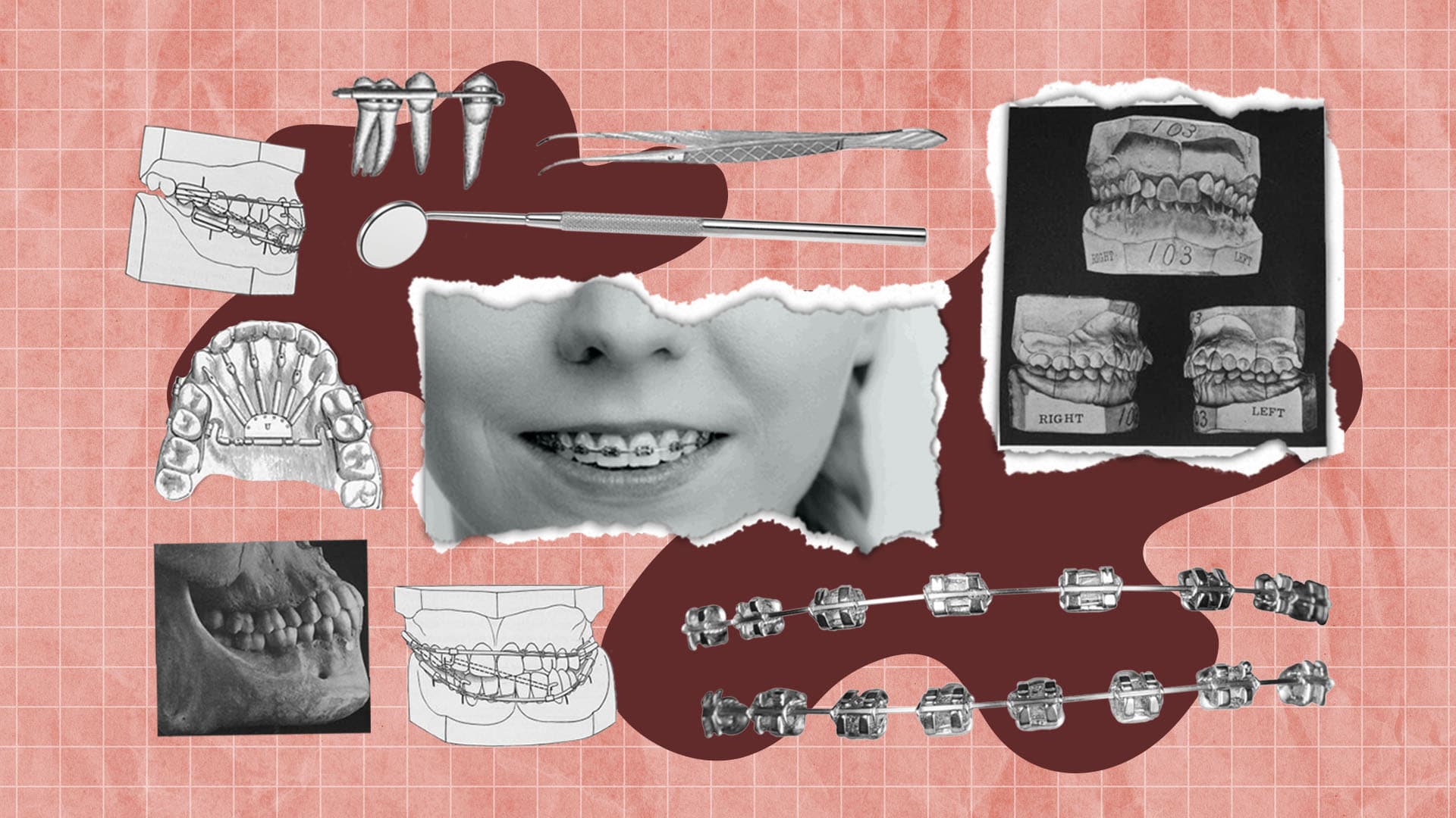 Do straight teeth and a perfect bite improve oral health?