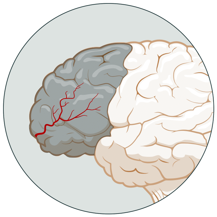 How Covid Affects the Body interactive graphic - Brain inset