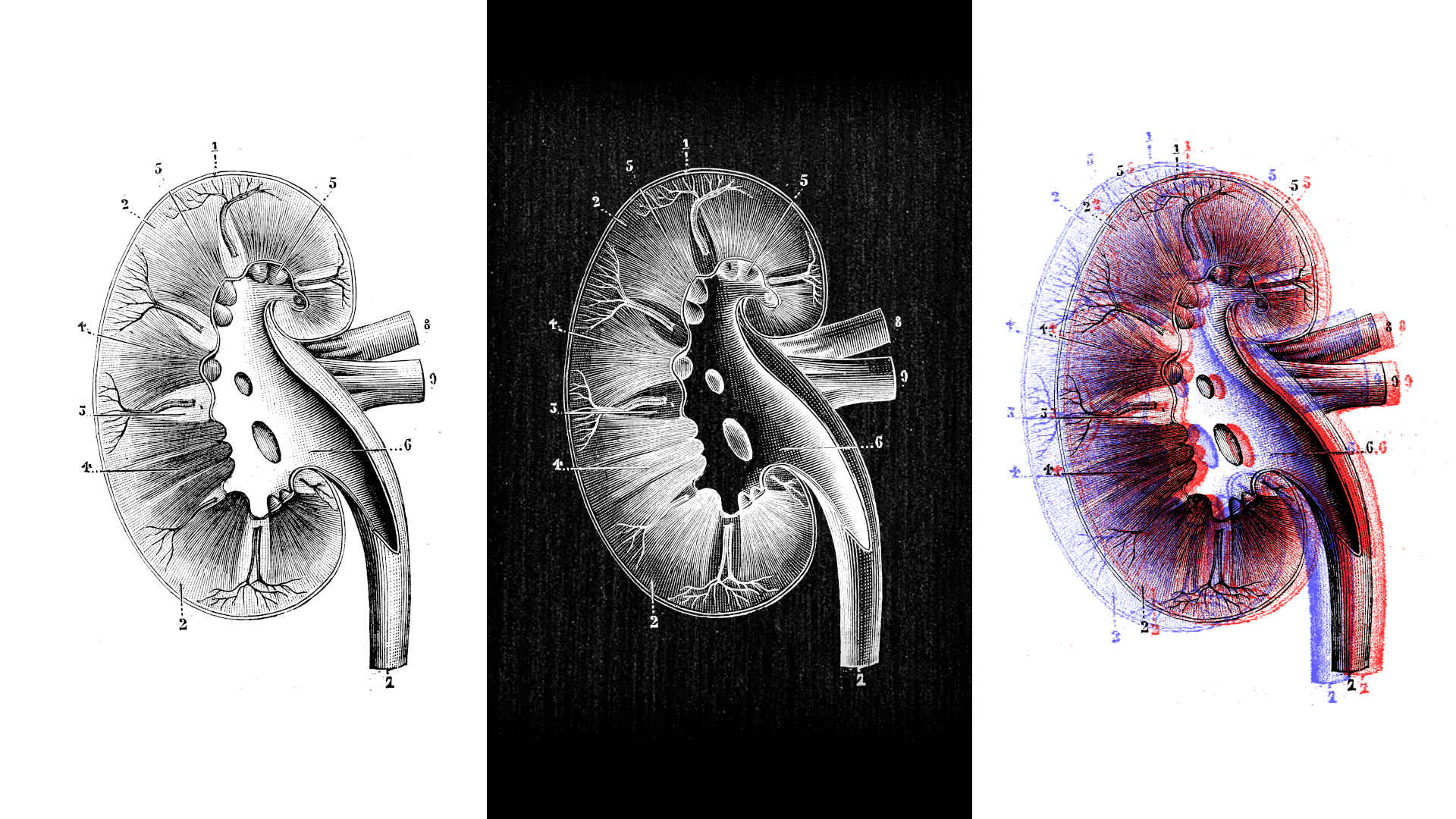 Illustration of a kidney.
